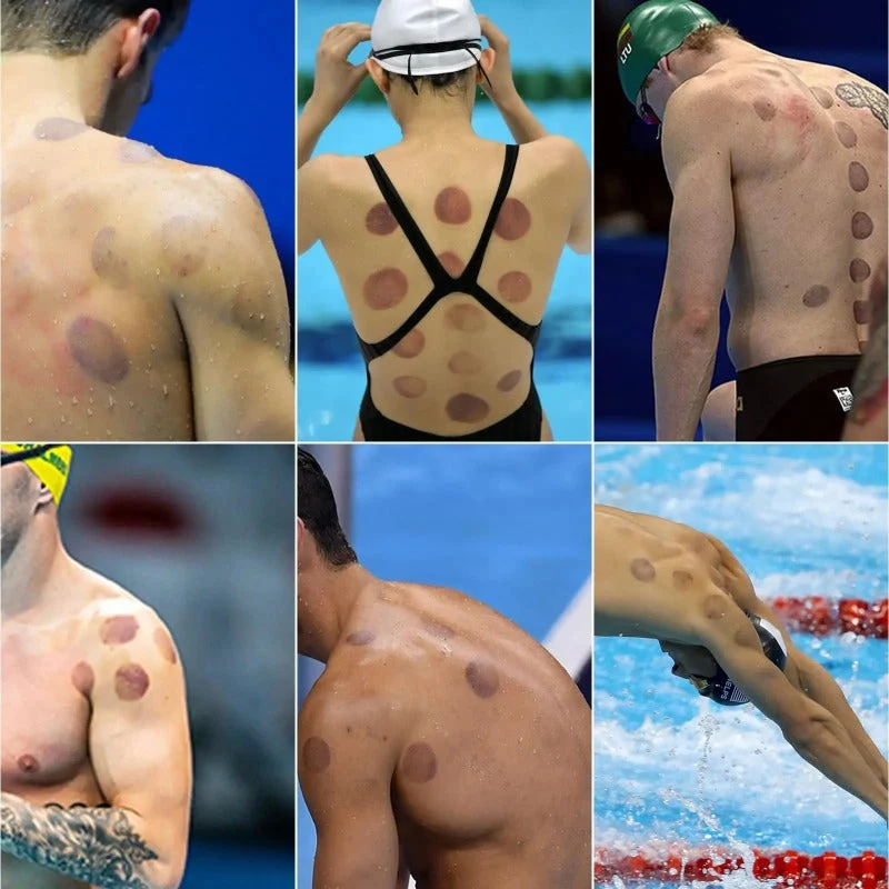 Muscle Pain Relief Cupping Set - Image 4