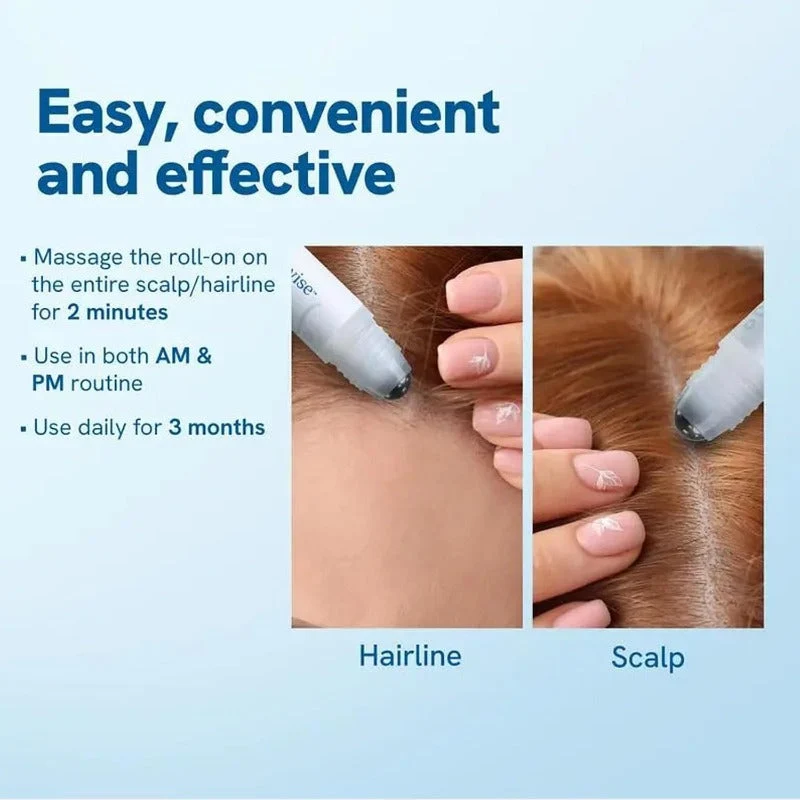 Rosemary Hair Growth Serum - Image 4